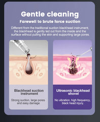Portable Ultrasonic Facial Scraper Deep Cleansing Blackhead Remover and Pore Cleaner for Face and Nose