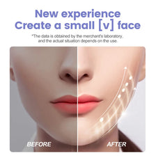 Portable Ultrasonic Facial Scraper Deep Cleansing Blackhead Remover and Pore Cleaner for Face and Nose