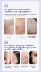 Portable Ultrasonic Facial Scraper Deep Cleansing Blackhead Remover and Pore Cleaner for Face and Nose