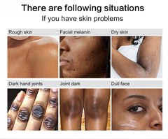 AILKE Glutathione PLUS Skin Care Set, Advanced Lightening Lotion, Moisturizes Softens Skin, Skin Bleaching Kit for Men, Women