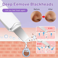 Electric Ultrasonic Skin Scrubber Vibration Face Spatula Peeling Blackhead Remover Facial Lifting Cleansing Ultrasonic Skin Care