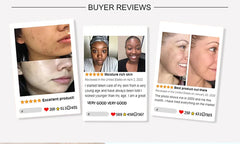 AILKE Glutathione PLUS Skin Care Set, Advanced Lightening Lotion, Moisturizes Softens Skin, Skin Bleaching Kit for Men, Women