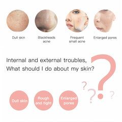 Electric Ultrasonic Skin Scrubber Vibration Face Spatula Peeling Blackhead Remover Facial Lifting Cleansing Ultrasonic Skin Care